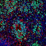 Neural differentiation of human embryonic stem cells 